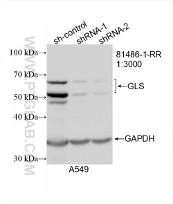 KGA/GAC Rabbit Recombinant Antibody, Proteintech:Antibodies:Primary Antibodies