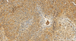 GP73/GOLPH2 Rabbit Recombinant Antibody, Proteintech:Antibodies:Primary