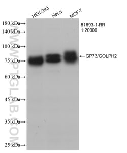 GP73/GOLPH2 Rabbit Recombinant Antibody, Proteintech:Antibodies:Primary