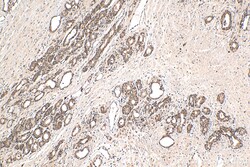 Glucocorticoid receptor Rabbit Recombinant Antibody, Proteintech Unconjugated;