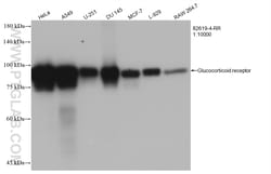 Glucocorticoid receptor Rabbit Recombinant Antibody, Proteintech Unconjugated;