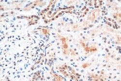 HNRNPL Rabbit Recombinant Antibody, Proteintech Unconjugated; 100 &mu;L:Antibodies,