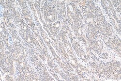 HNRNPL Rabbit Recombinant Antibody, Proteintech Unconjugated; 100 &mu;L:Antibodies,