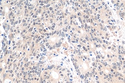 HNRNPL Rabbit Recombinant Antibody, Proteintech Unconjugated; 100 &mu;L:Antibodies,