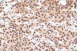 HNRNPL Rabbit Recombinant Antibody, Proteintech Unconjugated; 100 &mu;L:Antibodies,