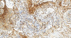 IGF2BP3 Rabbit Recombinant Antibody, Proteintech Unconjugated; 20 &mu;L:Antibodies,