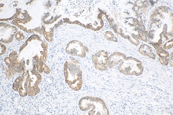 IGF2BP3 Rabbit Recombinant Antibody, Proteintech Unconjugated; 20 &mu;L:Antibodies,