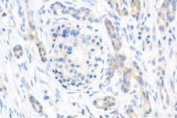 IGF2BP3 Rabbit Recombinant Antibody, Proteintech Unconjugated; 20 &mu;L:Antibodies,