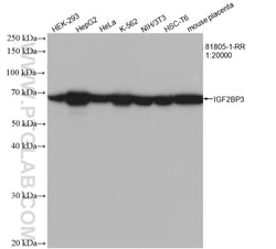 IGF2BP3 Rabbit Recombinant Antibody, Proteintech Unconjugated; 20 &mu;L:Antibodies,