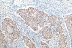 Proteintech IHCeasy Beta Catenin Ready-To-Use IHC Kit 1 set | Buy Online | Proteintech | Fisher Scientific