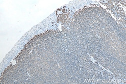 Proteintech IHCeasy CD20 Ready-To-Use IHC Kit 1 set | Buy Online | Proteintech | Fisher Scientific