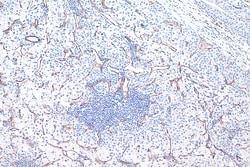 Proteintech IHCeasy CD31 gebrauchsfertiges IHC-Kit 50 Tests | Buy Online | Proteintech | Fisher Scientific