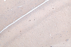 Proteintech IHCeasy TUBB3 Ready-To-Use IHC Kit 50 Tests | Buy Online | Proteintech | Fisher Scientific