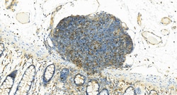 LASP1 Rabbit Recombinant Antibody, Proteintech:Antibodies:Primary Antibodies