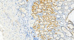 LASP1 Rabbit Recombinant Antibody, Proteintech:Antibodies:Primary Antibodies