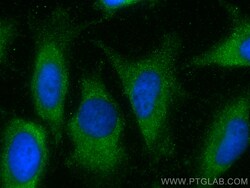 LASP1 Rabbit Recombinant Antibody, Proteintech:Antibodies:Primary Antibodies