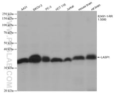 LASP1 Rabbit Recombinant Antibody, Proteintech:Antibodies:Primary Antibodies
