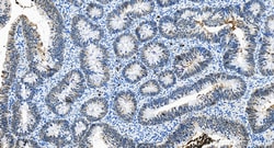 MPO Rabbit Recombinant Antibody, Proteintech:Antibodies:Primary Antibodies