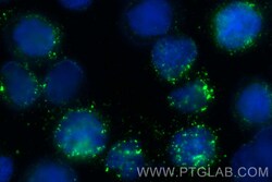 MPO Rabbit Recombinant Antibody, Proteintech:Antibodies:Primary Antibodies
