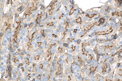 Moesin Rabbit Recombinant Antibody, Proteintech:Antibodies:Primary Antibodies