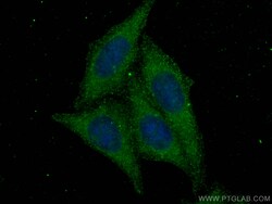 mTOR Rabbit Recombinant Antibody, Proteintech:Antibodies:Primary Antibodies