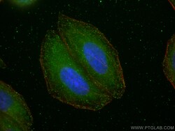 mTOR Rabbit Recombinant Antibody, Proteintech:Antibodies:Primary Antibodies
