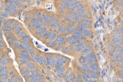 mTOR Rabbit Recombinant Antibody, Proteintech:Antibodies:Primary Antibodies