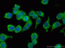 MX1 Rabbit Recombinant Antibody, Proteintech:Antibodies:Primary Antibodies