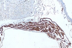 MYL7 Rabbit Recombinant Antibody, Proteintech:Antikörper:Primärantikörper