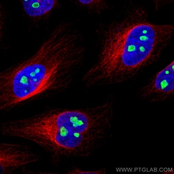 NAT10 Rabbit Recombinant Antibody, Proteintech:Antibodies:Primary Antibodies