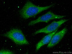 NRF2, NFE2L2 Rabbit Recombinant Antibody, Proteintech:Antikörper:Primärantikörper