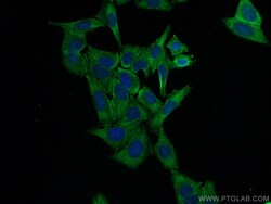NRF2, NFE2L2 Rabbit Recombinant Antibody, Proteintech:Antikörper:Primärantikörper