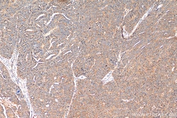 NRF2, NFE2L2 Rabbit Recombinant Antibody, Proteintech:Antikörper:Primärantikörper
