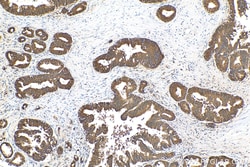 NRF2, NFE2L2 Rabbit Recombinant Antibody, Proteintech:Antikörper:Primärantikörper
