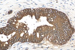 NRF2, NFE2L2 Rabbit Recombinant Antibody, Proteintech:Antikörper:Primärantikörper