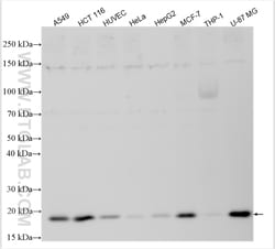 P21 Rabbit Recombinant Antibody, Proteintech:Antibodies:Primary Antibodies