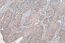 PEX14 Rabbit Recombinant Antibody, Proteintech Unconjugated; 100 &mu;L:Antibodies