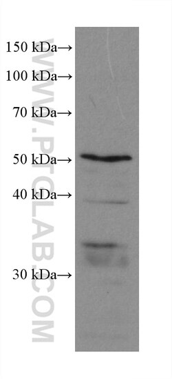 PEX14 Rabbit Recombinant Antibody, Proteintech Unconjugated; 100 &mu;L:Antibodies