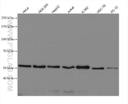 PEX14 Rabbit Recombinant Antibody, Proteintech Unconjugated; 100 &mu;L:Antibodies