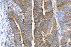 PHGDH Rabbit Recombinant Antibody, Proteintech:Antibodies:Primary Antibodies