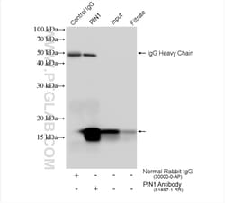 PIN1 Rabbit Recombinant Antibody, Proteintech 100 &mu;L | Buy Online | Proteintech | Fisher Scientific