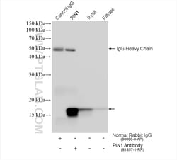 PIN1 Rabbit Recombinant Antibody, Proteintech 100 &mu;L | Buy Online | Proteintech | Fisher Scientific