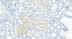 PTRF Rabbit Recombinant Antibody, Proteintech:Antibodies:Primary Antibodies