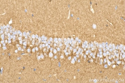 SEPT4 Rabbit Recombinant Antibody, Proteintech:Antibodies:Primary Antibodies