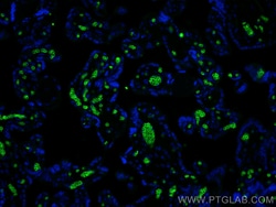 Band 3/AE 1 Rabbit Recombinant Antibody, Proteintech:Antibodies:Primary