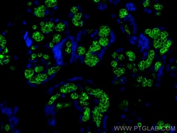 Band 3/AE 1 Rabbit Recombinant Antibody, Proteintech:Antibodies:Primary