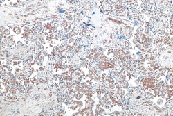 Band 3/AE 1 Rabbit Recombinant Antibody, Proteintech:Antibodies:Primary