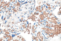 Band 3/AE 1 Rabbit Recombinant Antibody, Proteintech:Antibodies:Primary