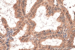 STAT1 Rabbit Recombinant Antibody, Proteintech:Antibodies:Primary Antibodies