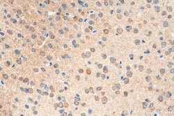 SYNPO Rabbit Recombinant Antibody, Proteintech:Antibodies:Primary Antibodies